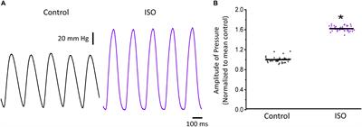 Transmural Autonomic Regulation of Cardiac Contractility at the Intact Heart Level